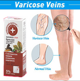 كريم مكافحة الدوالي و التهاب الأوعية  الدموية