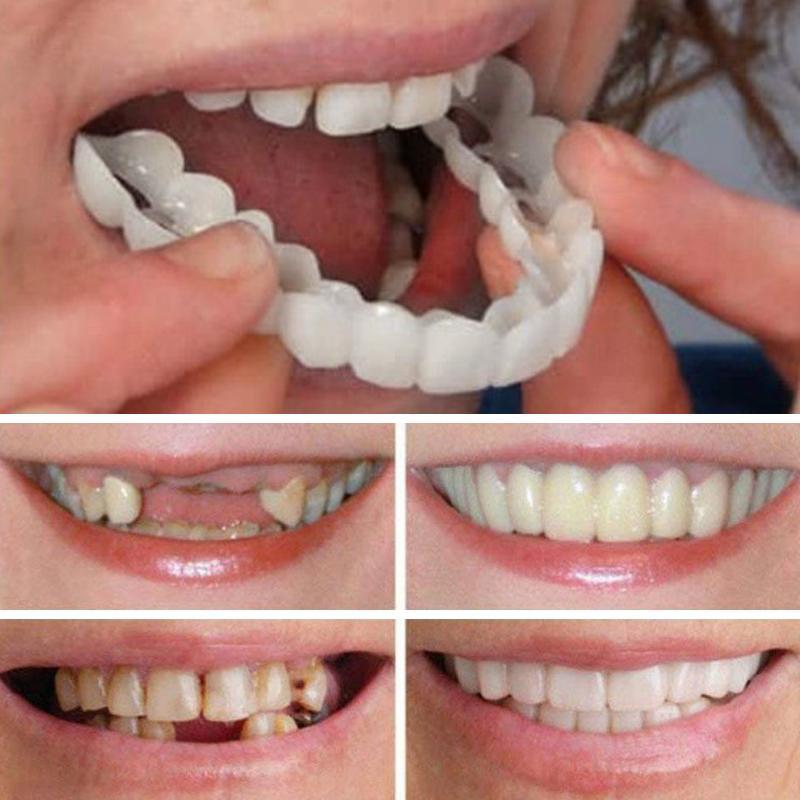 MAGIC HOLLYWOOD SMILE - للفكين - bizmaroc.ma