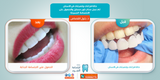 Miracle Beauty Miracles (بيروكسيد الهيدروجين) - bizmaroc.ma