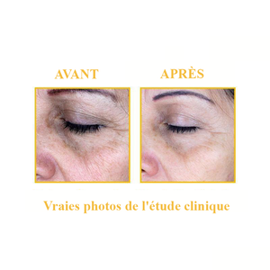 Serum Ampoule Blanchissant - bizmaroc.ma